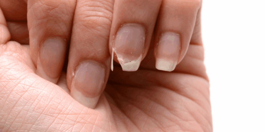 Mulher olhando com frustração para sua unha quebrada, representando o problema das unhas fracas e quebradiças